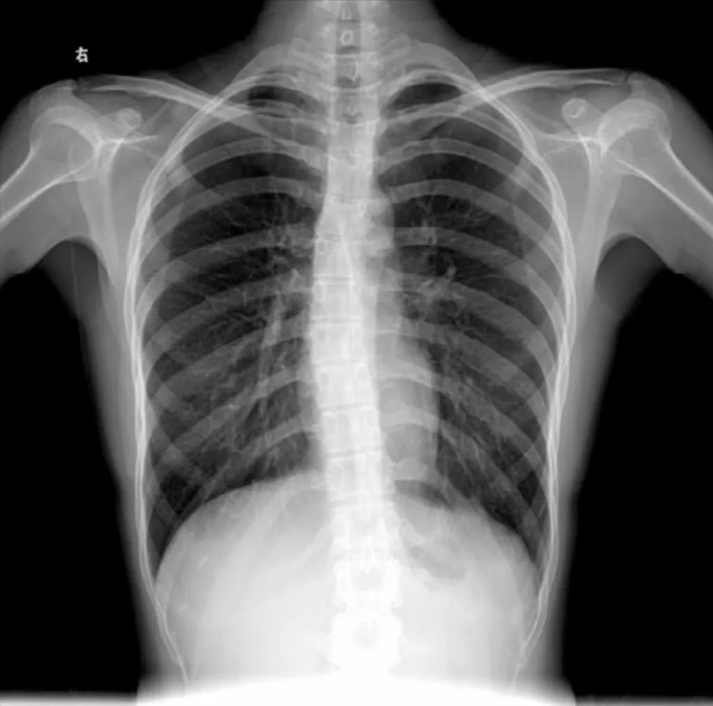 坐仰卧起坐的器材叫什么_器材仰卧起坐的正确做法_仰卧起坐器材多少钱