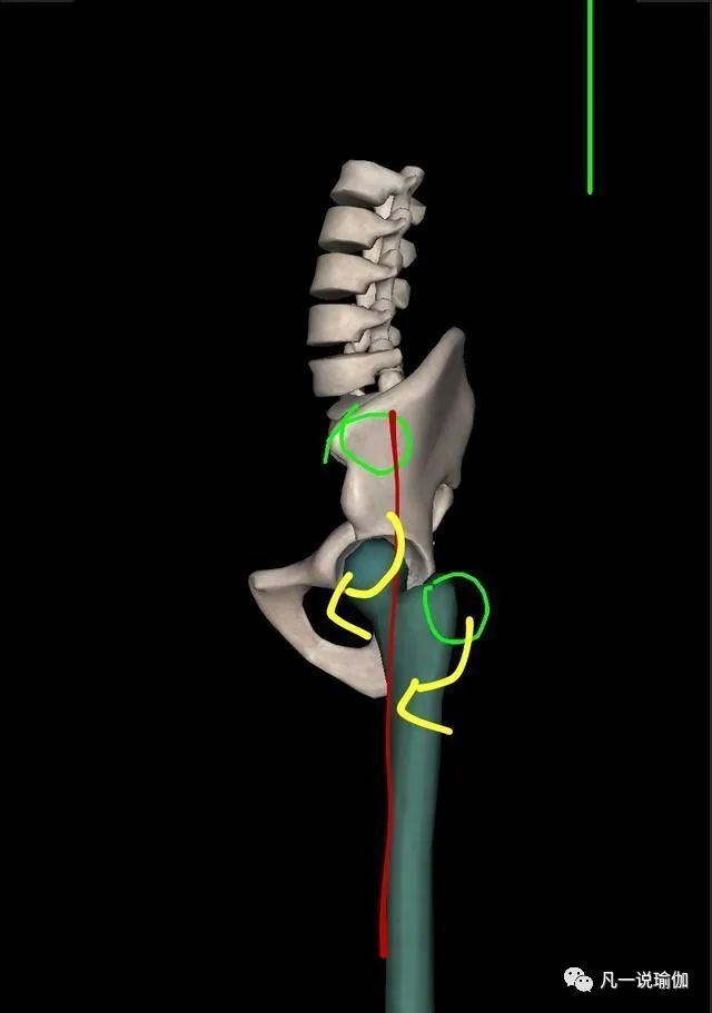 假胯宽可以做正骨纠正吗_假胯宽可以用骨盆带吗_假胯宽可以做骨盆修复吗
