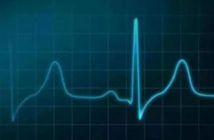 跑步时心率过快好吗?_慢跑黄金时长_科学慢跑时长