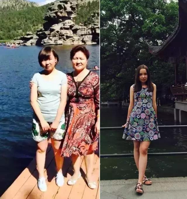 减肥真实经历分享_梨形身材甩油操_减肥前后对比图