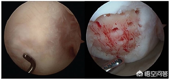 微信运动一万步距离_关联微信运动的计步器_每天一万步能减肥吗