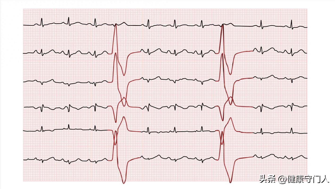pg电子麻将胡了 这五项指标正常，说明你的心脏基本健康，不用瞎折腾了