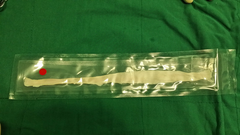 前交叉韧带康复训练图_交叉韧带运动康复_请为我找到交叉韧带康复视频