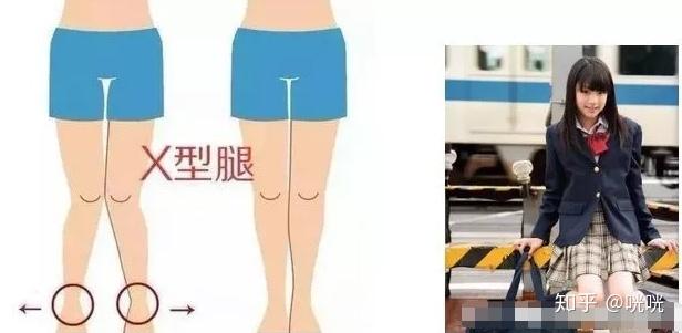 脂肪腿改善法_瘦腿操练视频_瘦腿训练方法