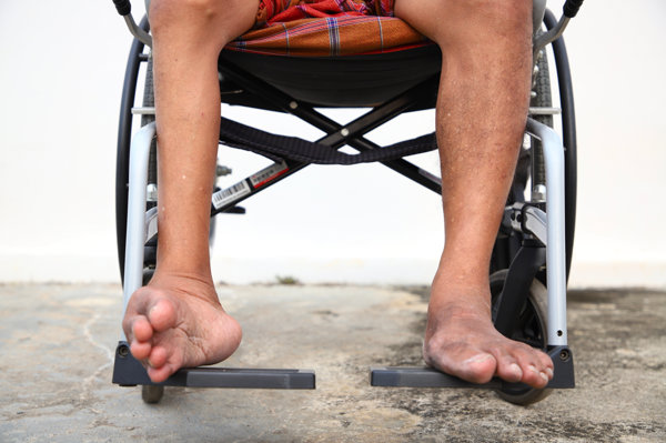 pg电子麻将胡了 二手脑瘫下肢康复训练器材