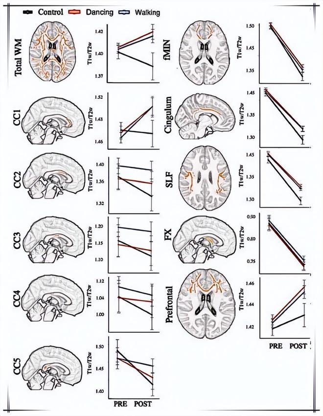 练肌肉是否影响身高_练腿提升认知能力_运动促进大脑发育