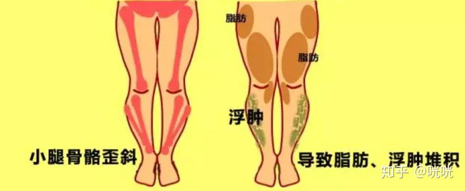 瘦腿操下载_肌肉腿矫正_脂肪腿训练