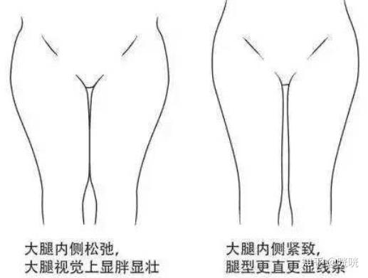 肌肉腿矫正_脂肪腿训练_瘦腿操下载