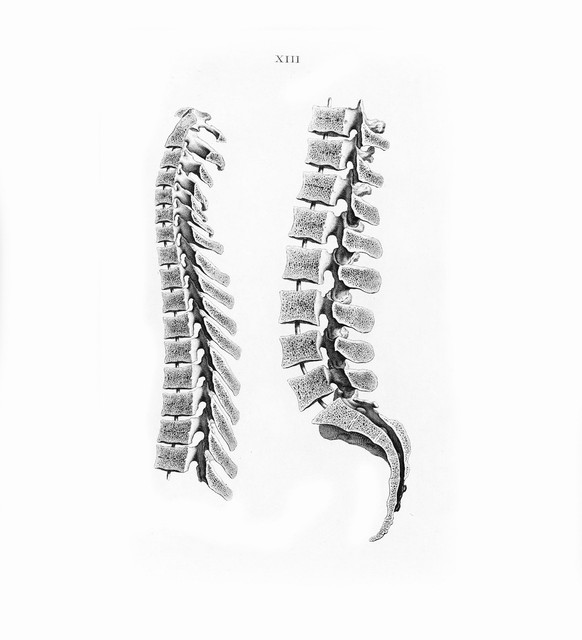 久坐不动腰伤_腰椎间盘突出不能弯腰_腰椎间盘突出坏习惯