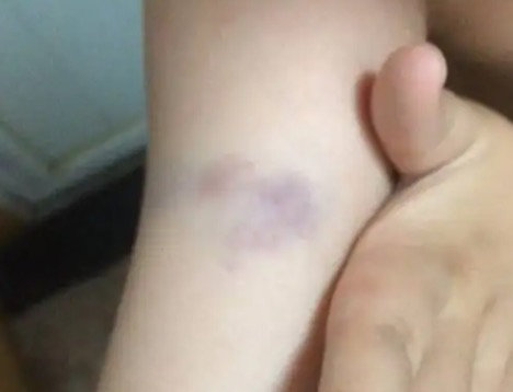 综合训练器怎么样贴吧_筋膜枪选购骗局_筋膜枪使用副作用