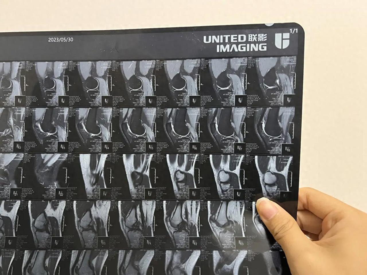 pg电子麻将胡了入口下载 大坡度跑步机选购攻，易跑M5 Pro、麦瑞克X5、舒华A9跑步机测评